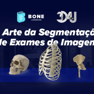 A Arte da Segmentação de Exames de Imagem